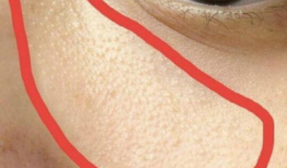 麻豆儿毛周角化修复霜,焕肤新选择，告别粗糙肌肤